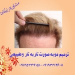 کاشت و ترمیم موی موتاب (بدون جراحی )